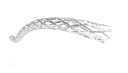 stent 11 .136 - Copy.png
